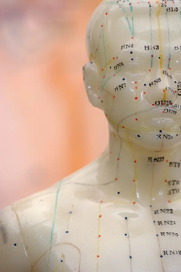 Acupuncture meridian model representing Springwell’s traditional and modern approach